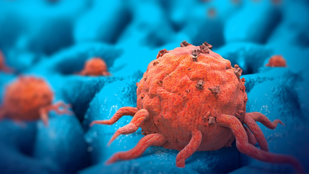 oncology