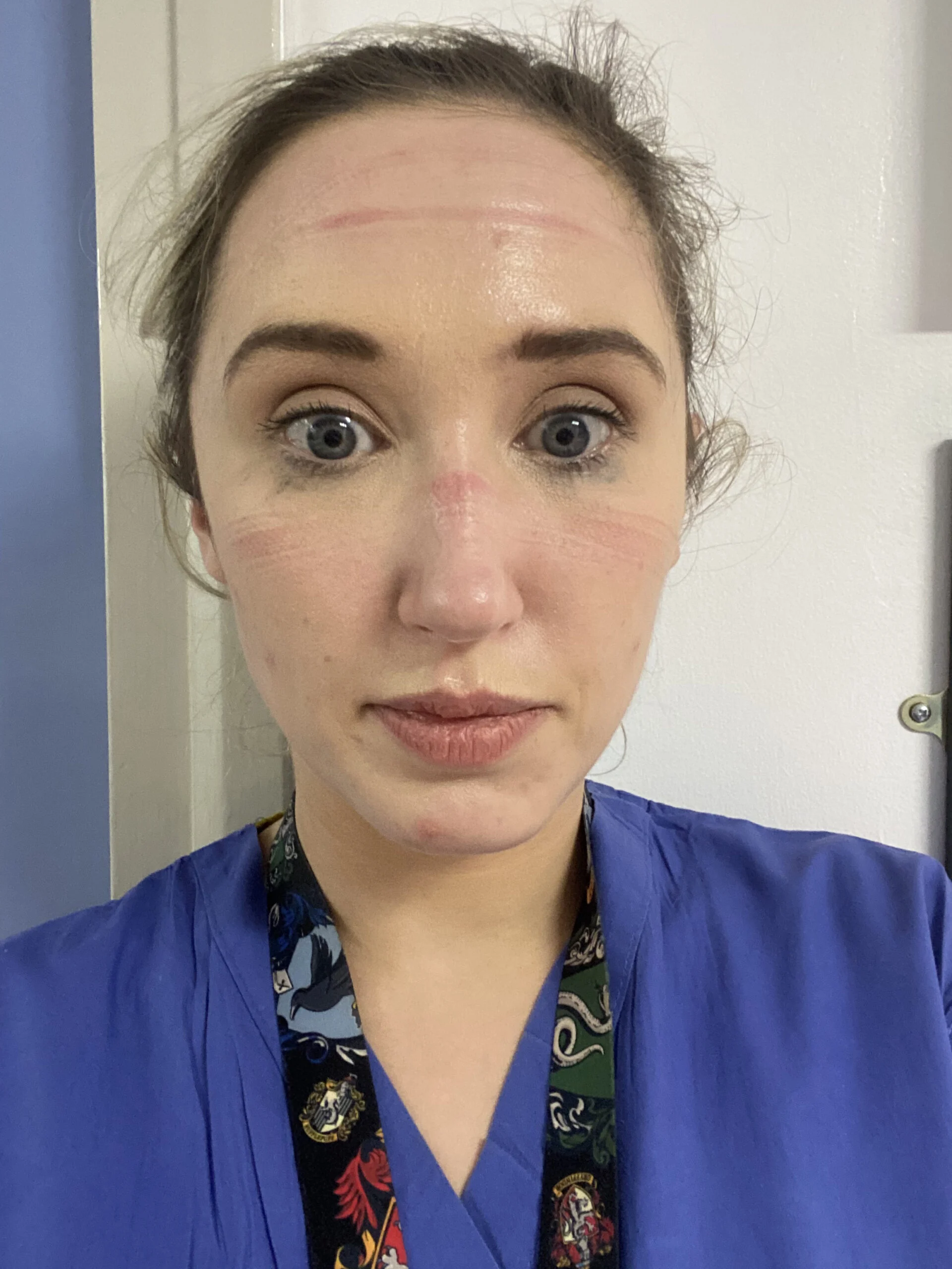 Natalie McEvoy facial injuries