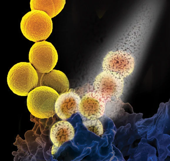 A colorized scanning electron micrograph of a white blood cell eating MRSA.