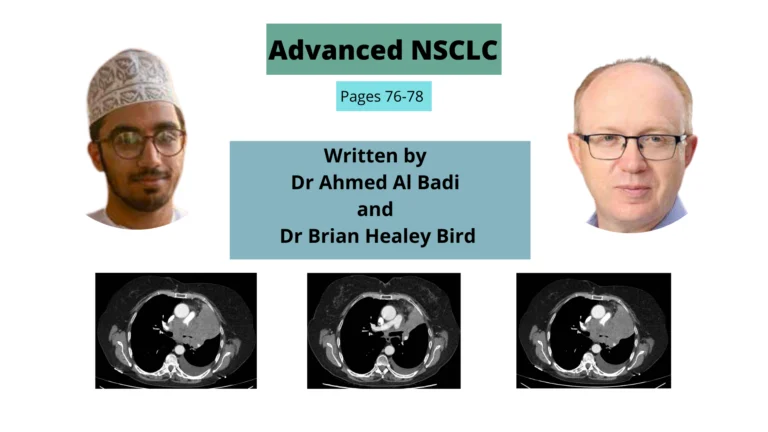 advanced nsclc