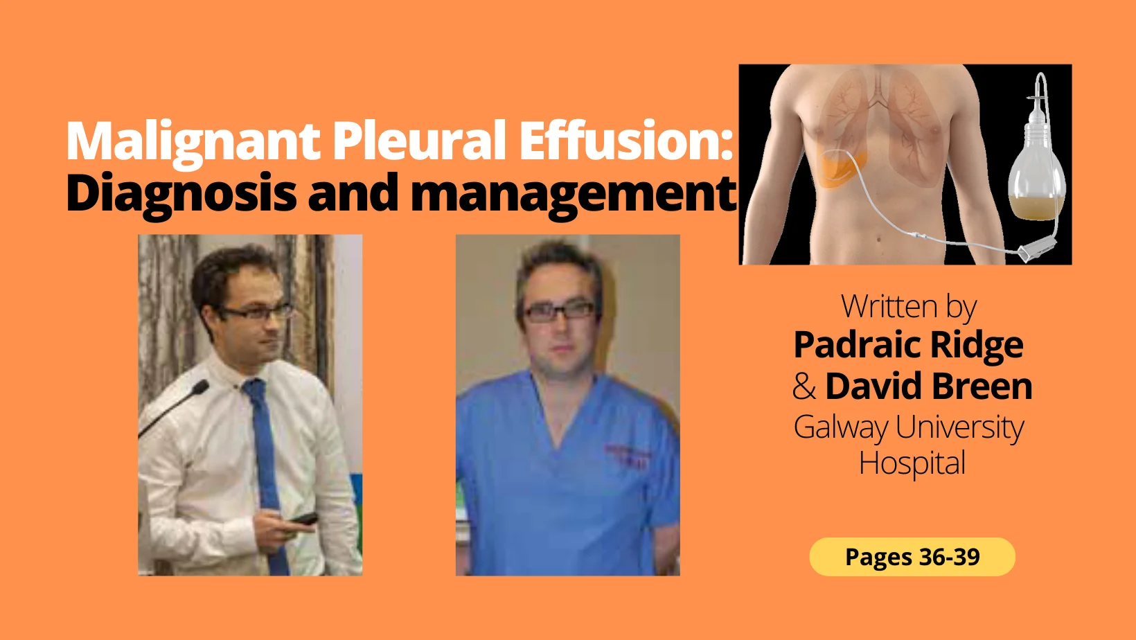 Malignant Pleural Effusion