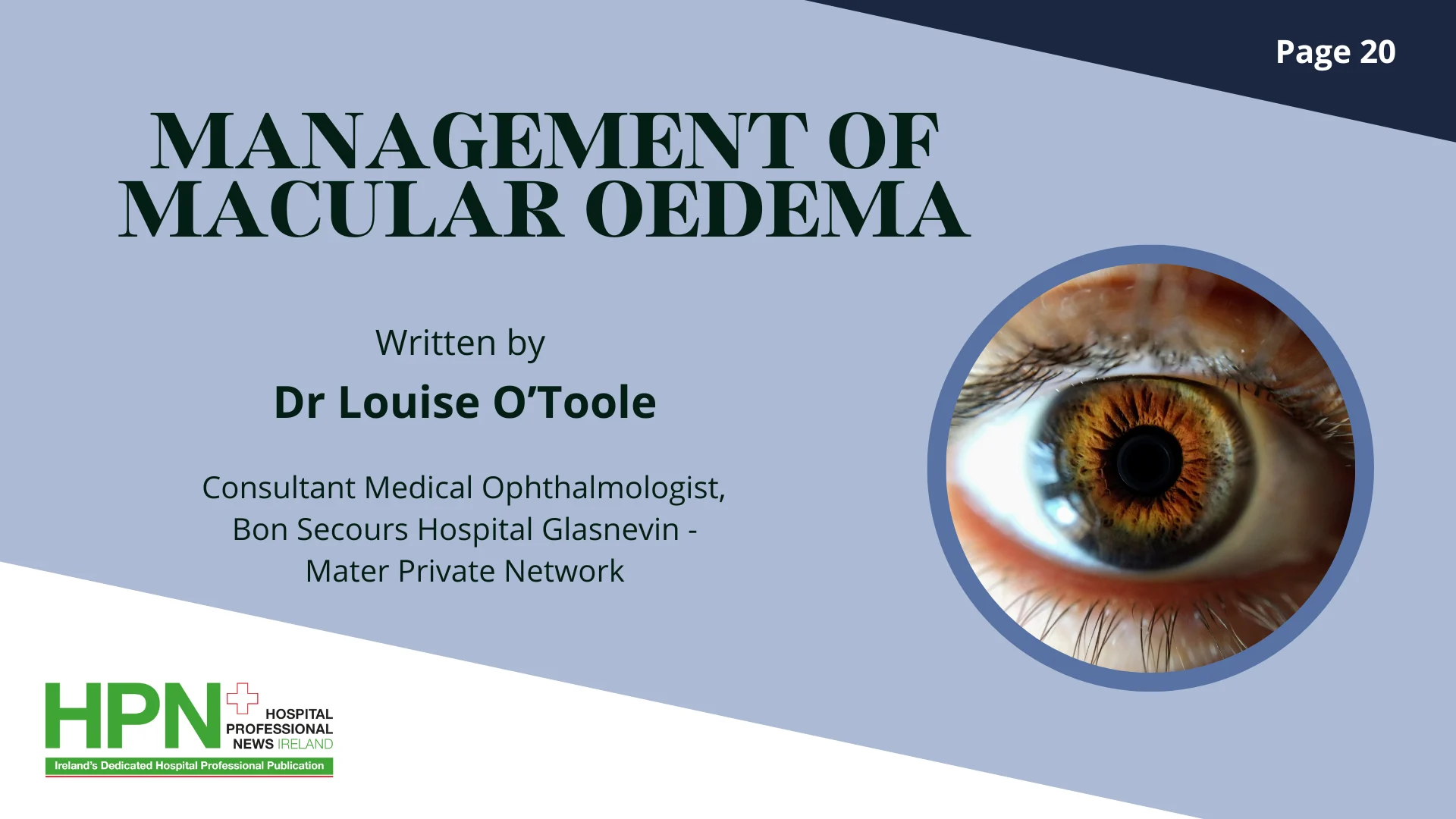 macular oedema