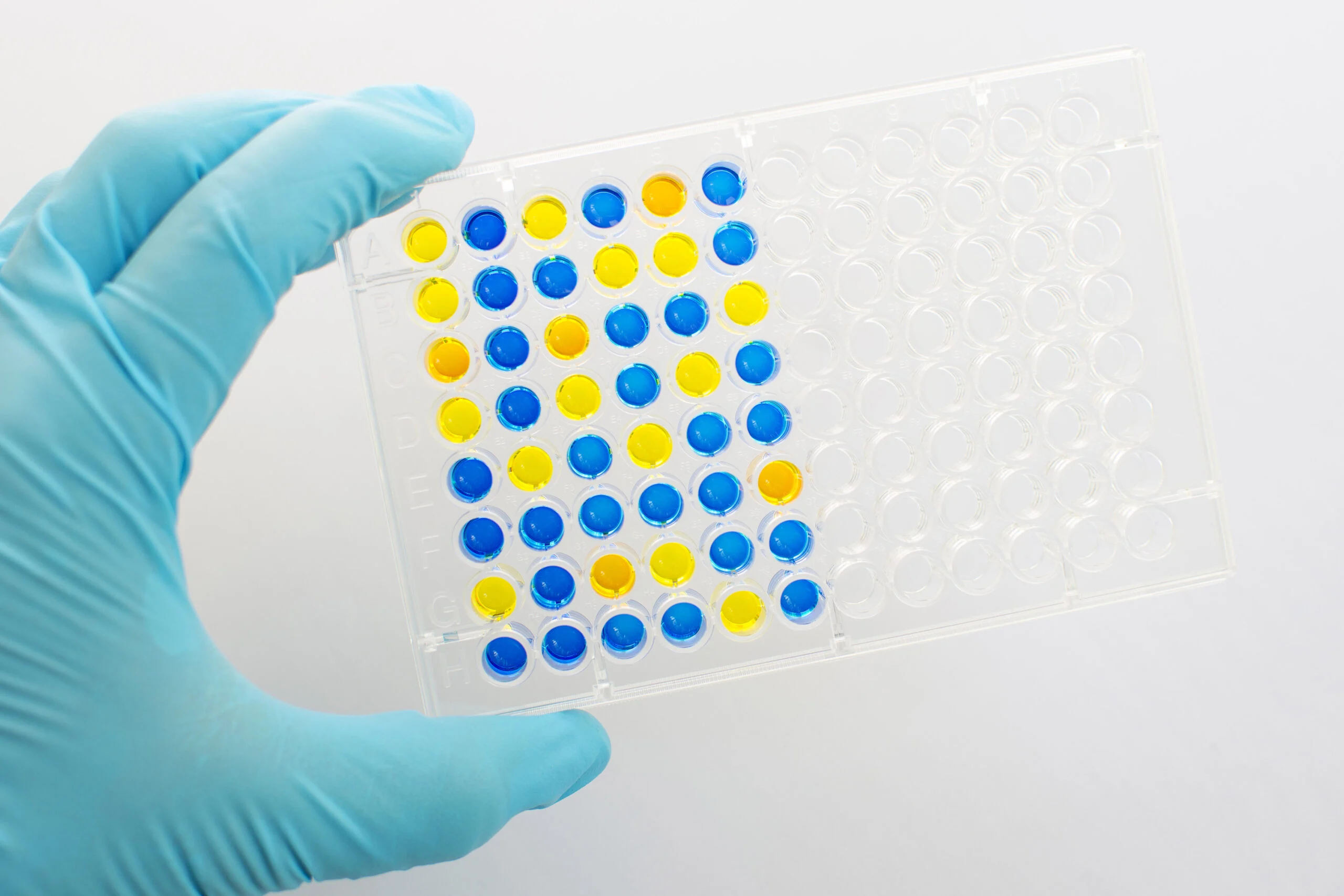 Enzyme-linked,Immunosorbent,Assay,(elisa),,Immunology,Testing,Method,In,96,Wells