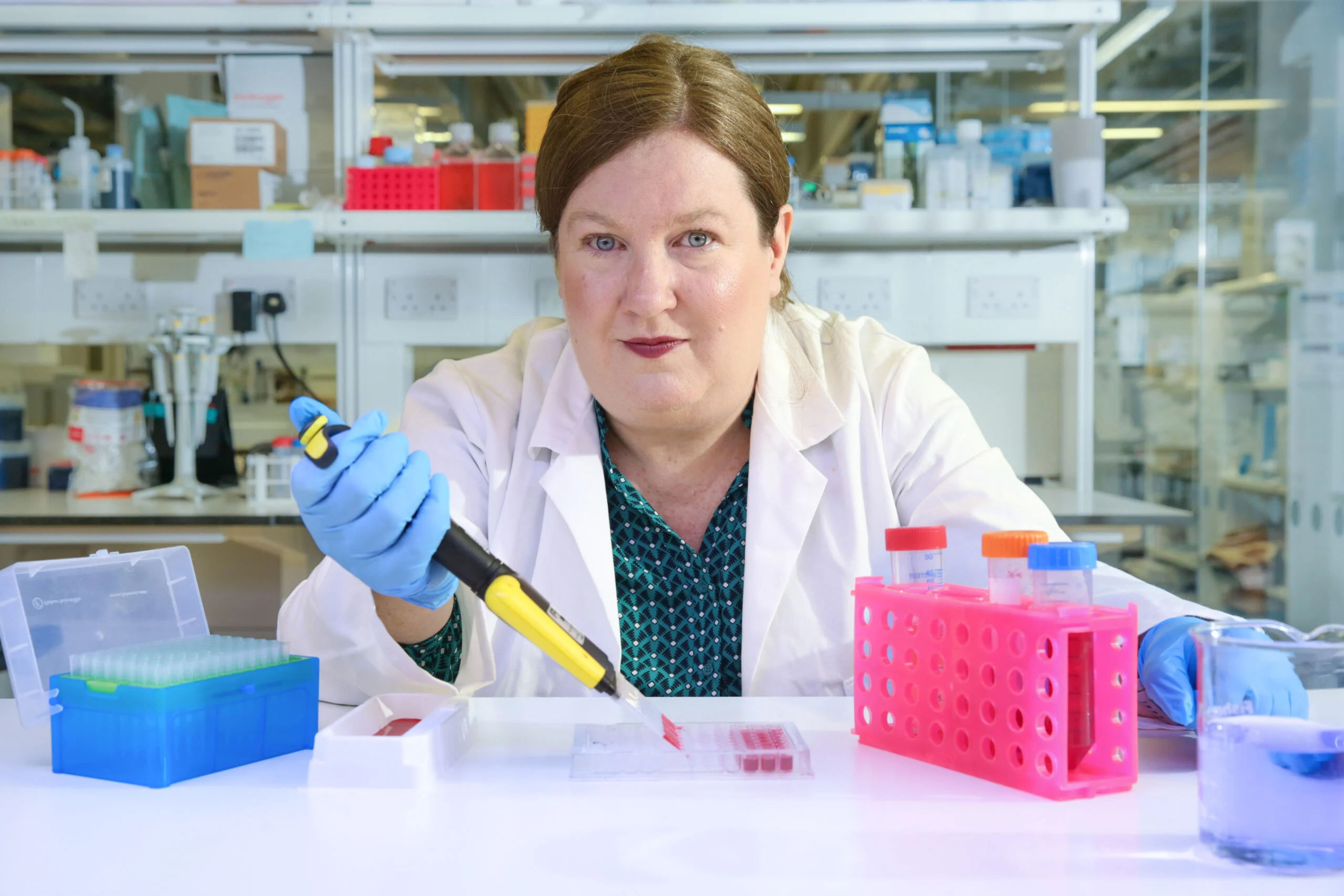 Researchers at University of Galway are to lead an international research project exploring innovative therapeutics targeting one of the most aggressive and challenging cancers to affect women – Triple Negative Breast Cancer (TNBC).