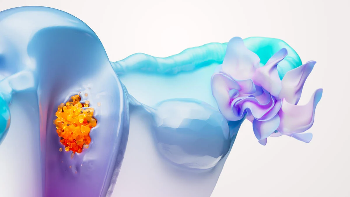 Positive RUBY phase III data show potential for dostarlimab combinations in more patients with primary advanced or recurrent endometrial cancer