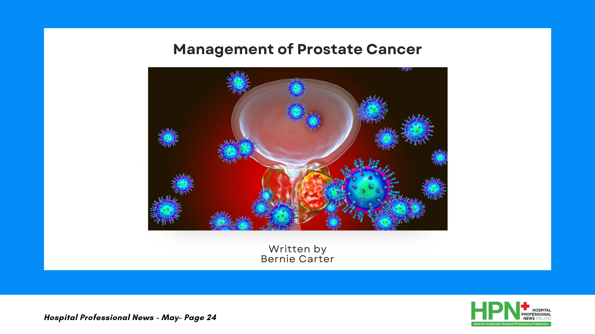 prostate cancer