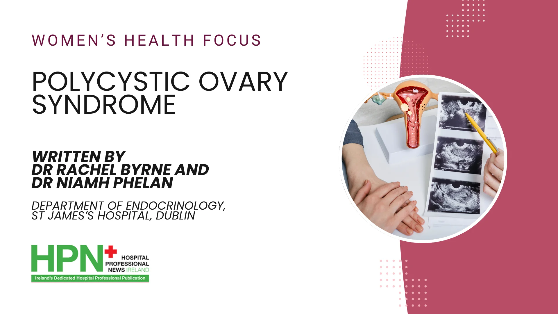 Polycystic Ovary Syndrome (PCOS)