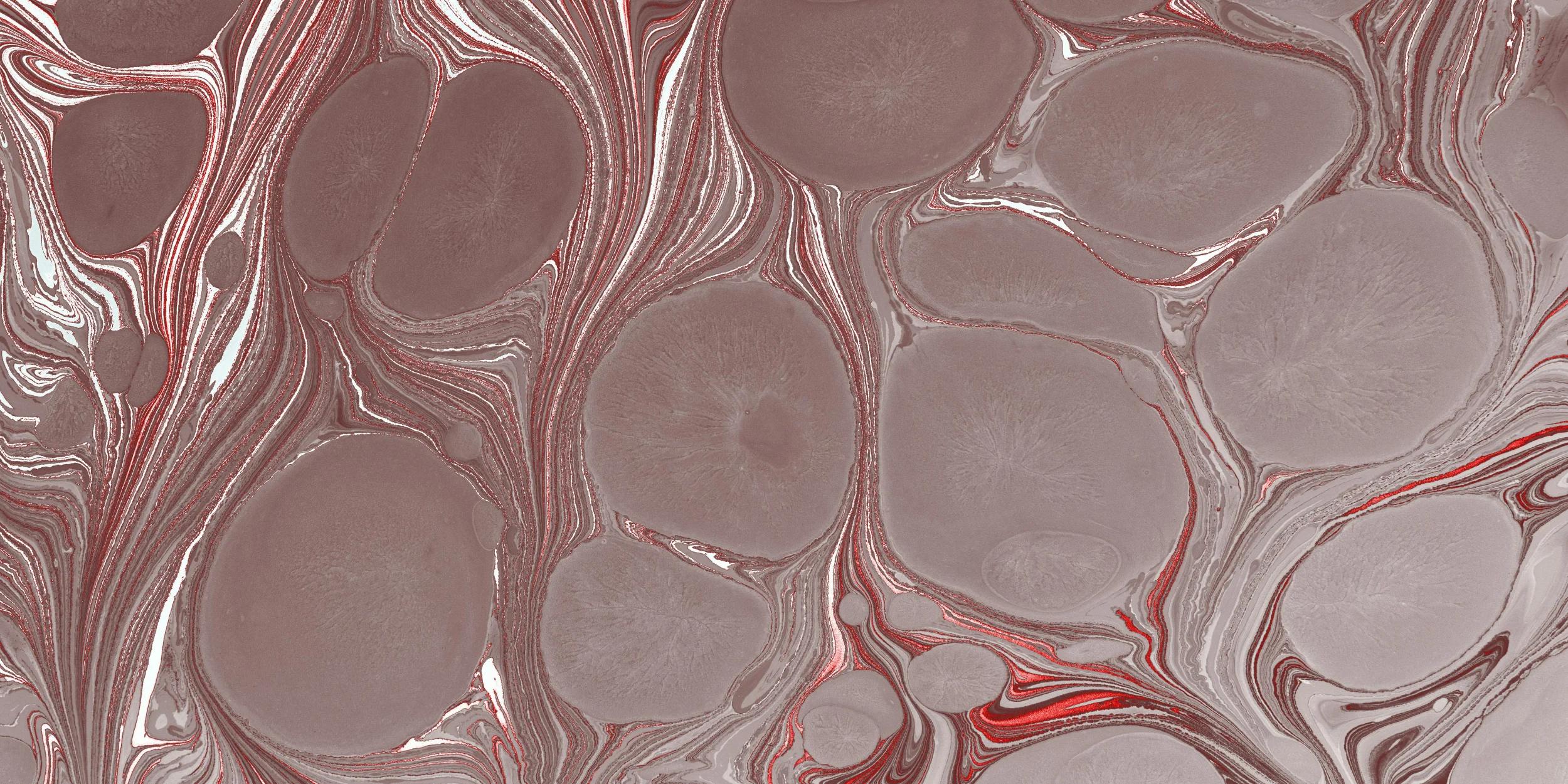 Epidermolysis Bullosa